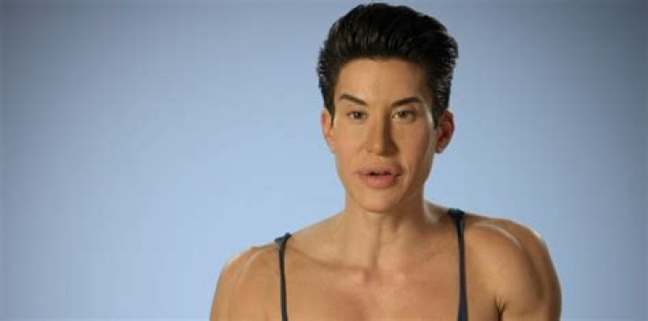 Botched Recap 7/6/14: Season 1 Episode 3 “Vagina Bomb!” Botched Recap 7/6/14: Season 1 Episode 3 “Vagina Bomb!”