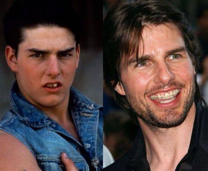 Strangest Things About Tom Cruise’s Teeth And Smile