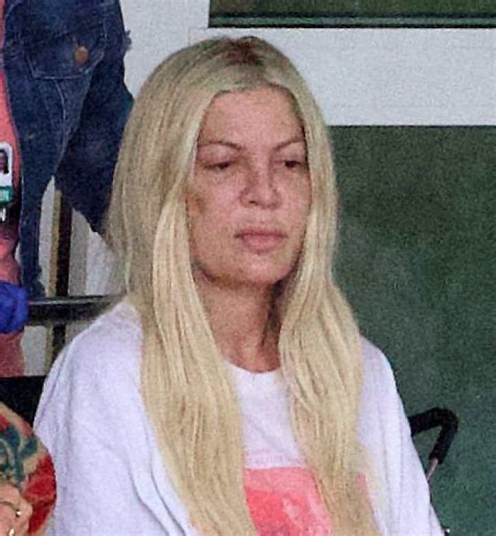 Tori Spelling Hospital Emergency: Drastic Weight Loss Due To Anorexia - 92 Pounds! (PHOTOS)